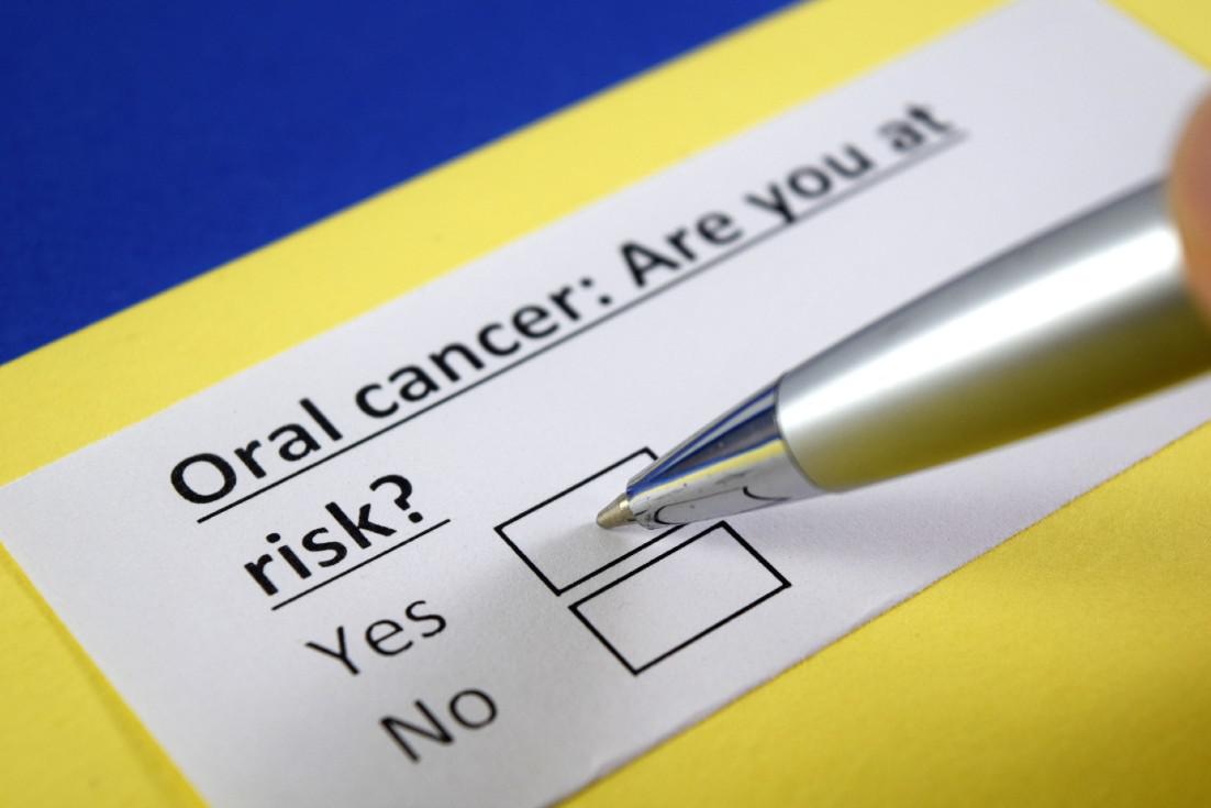 Top 5 Risk Factors of Oral Cancer